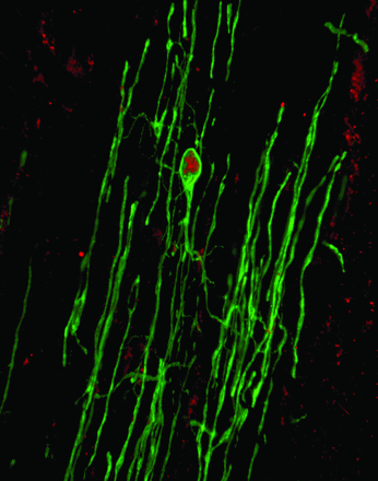 J Neurosci cover image